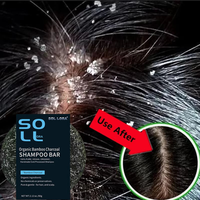 Fast Anti Dandruff Hair Treatm - đánh giá và giá Hair Care Dandruff
