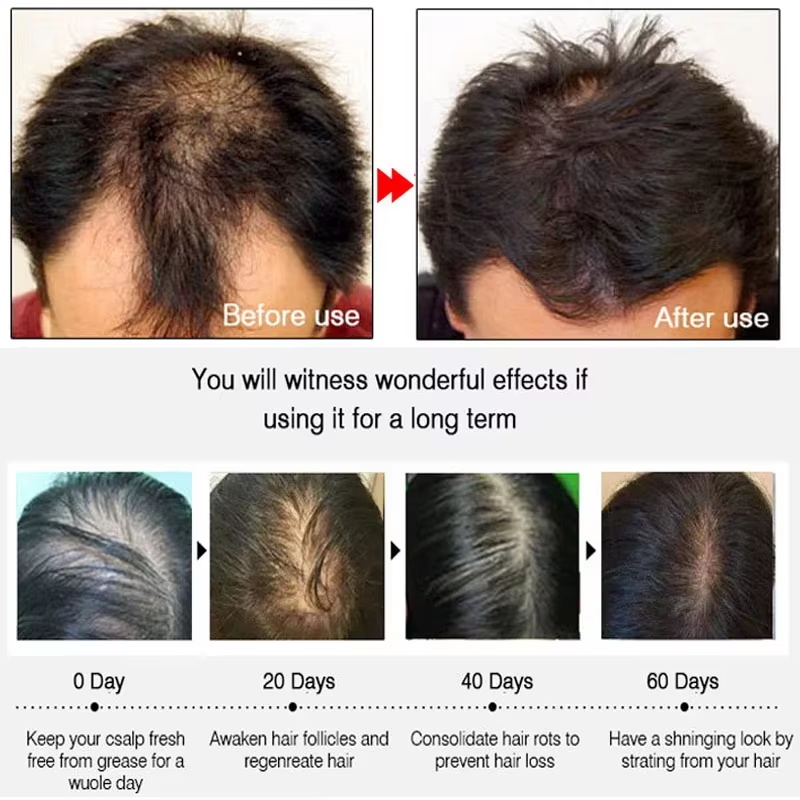 Fast Ginger Hair Growth Spray  - đánh giá và giá Hair Care Products