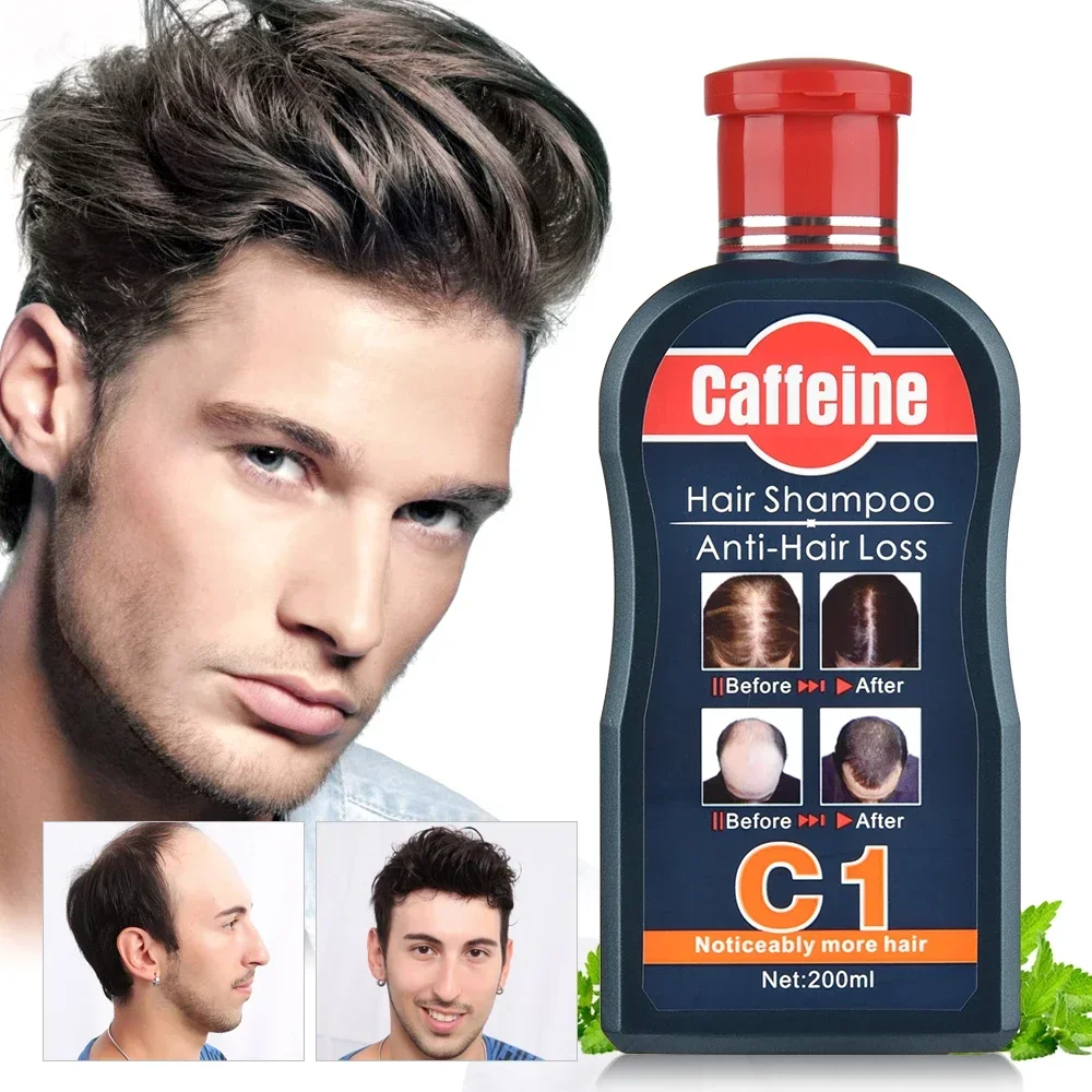 Men Shampoo For Hair Growth Na - đánh giá và giá Hair Care Korean Products