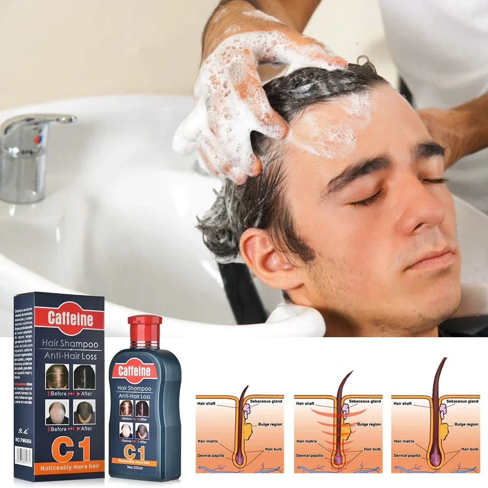 Men Shampoo For Hair Growth Na - đánh giá và giá Hair Care Korean Products