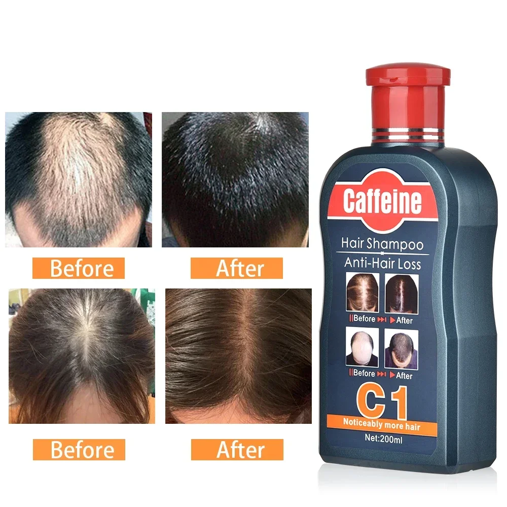 Men Shampoo For Hair Growth Na - đánh giá và giá Hair Care Korean Products